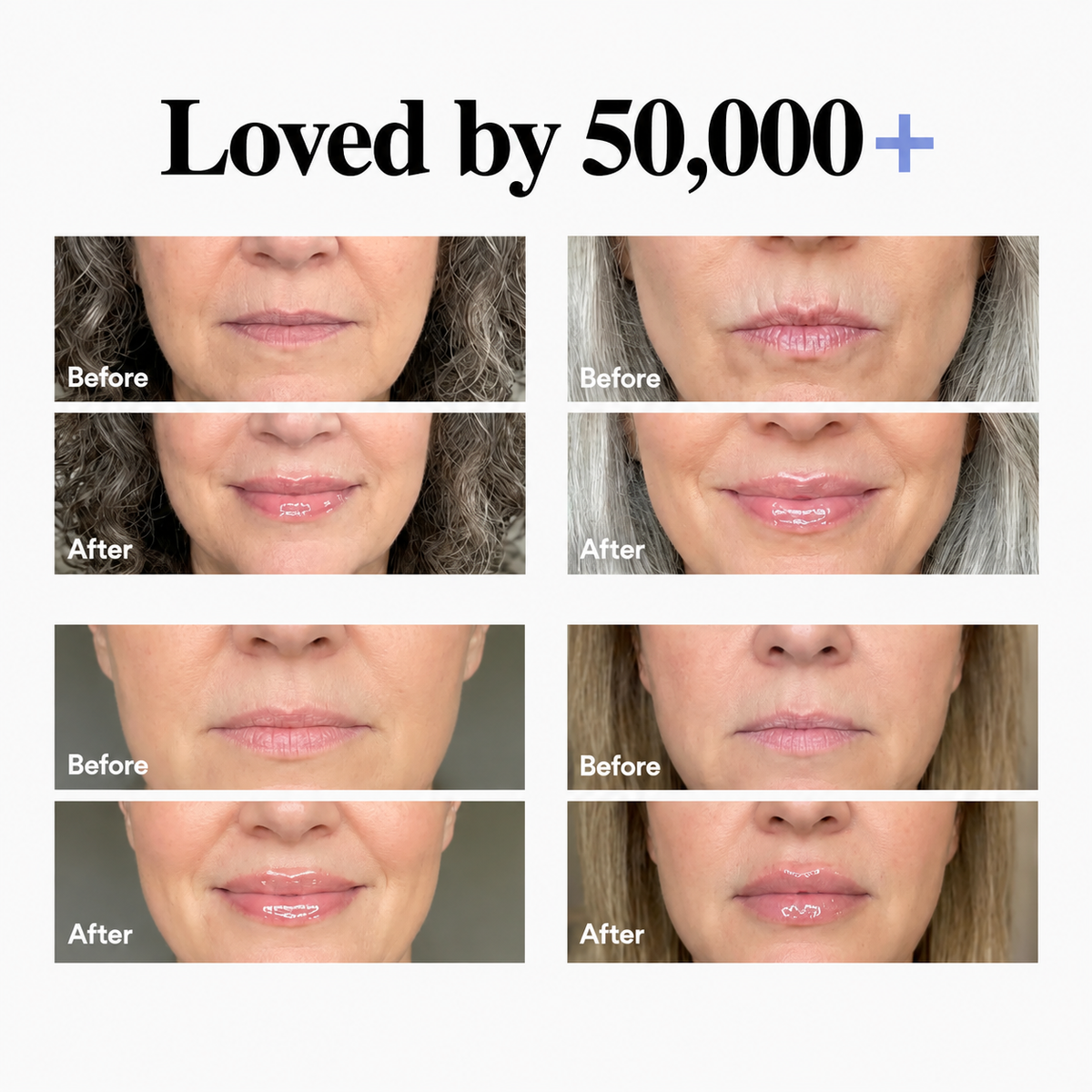 Lip Serum NL