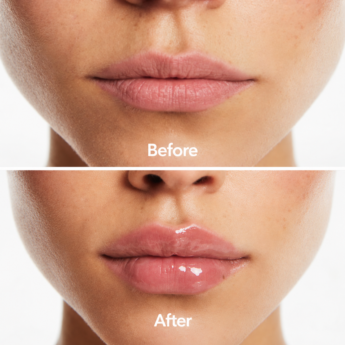 Lip Serum NL