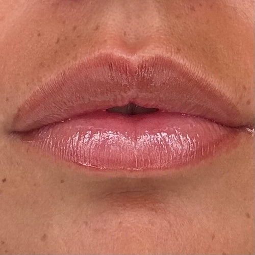 3. Follow with the serum