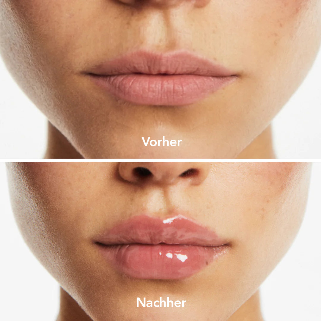Lip Serum
