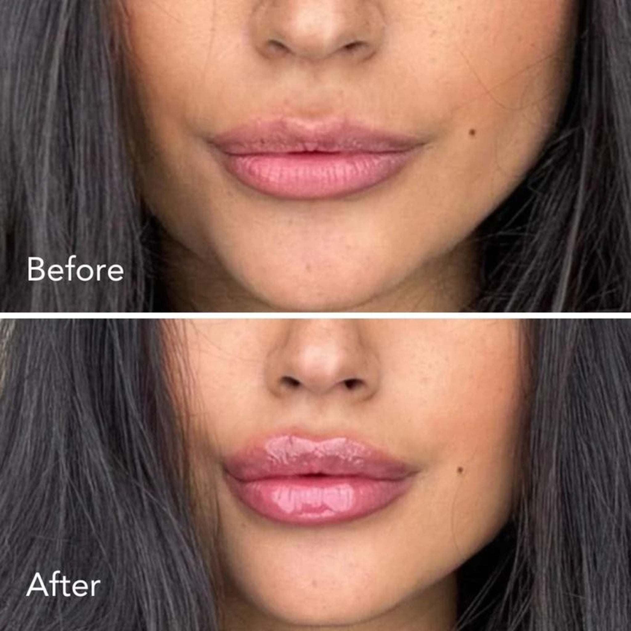Teré Lip Treatment Serum